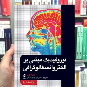 نوروفیدبک مبتنی بر الکتروانسفالوگرافی ارجمند